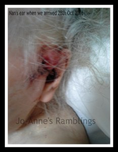Nans ear 28-10-15
